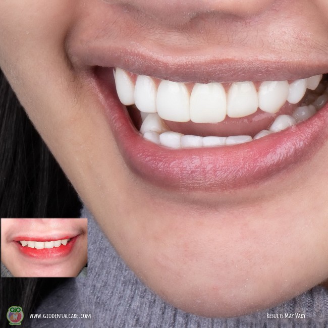 get-your-smile-here--1